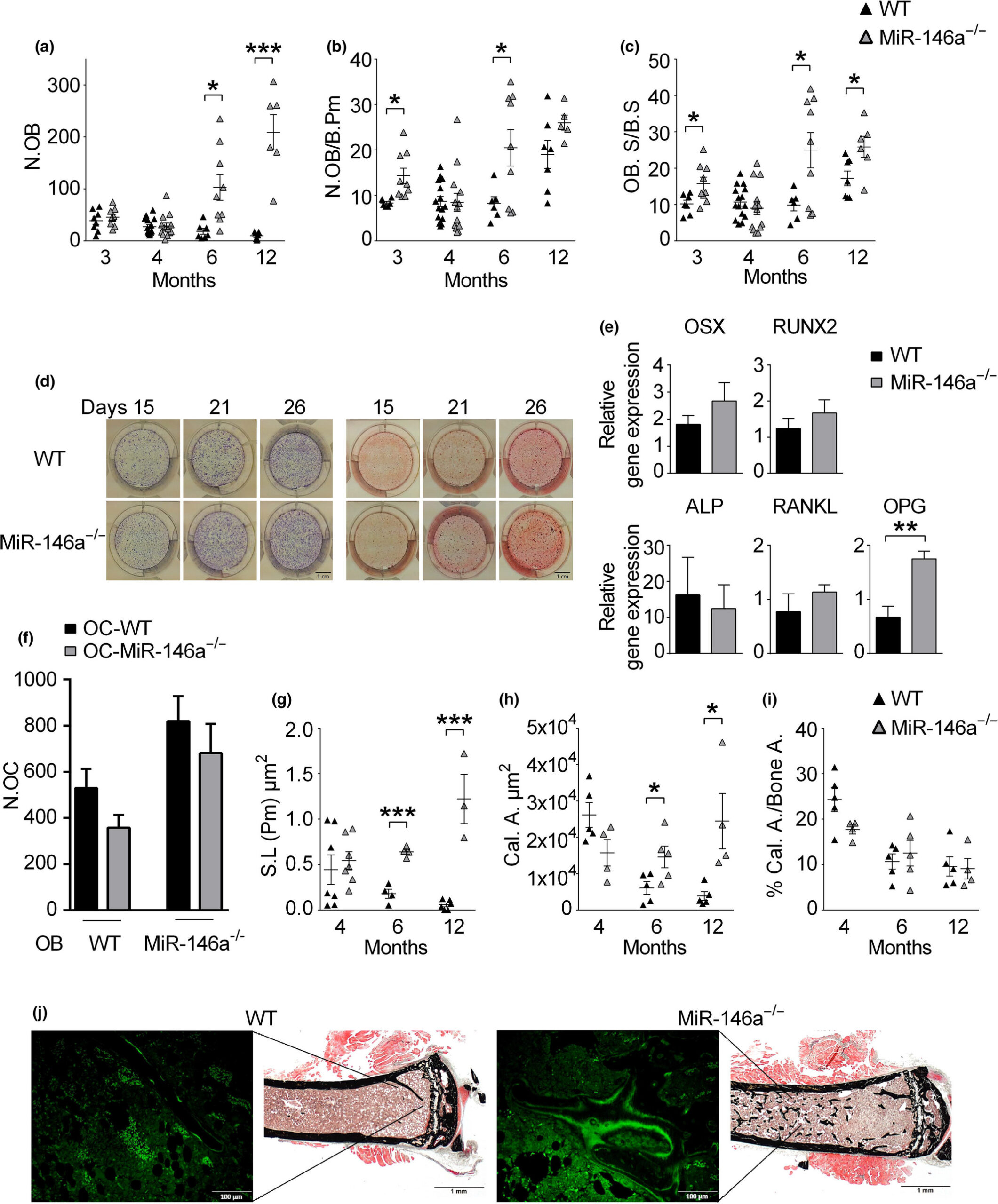 microRNA‐146a_controls_age‐related_bone_loss