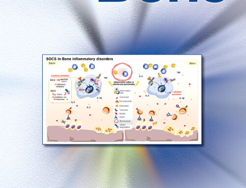 Circulating miRNAs in bone health and disease