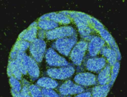 Unique miRNome and transcriptome profiles underlie microvascular heterogeneity in mouse kidney
